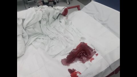 DOR Caller STABBED At Walmart By A Virtue Signaling M@sked Zombie!