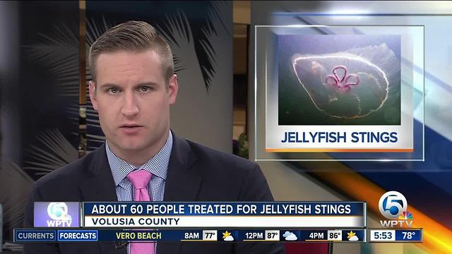 60 stung by jellyfish on Florida beach