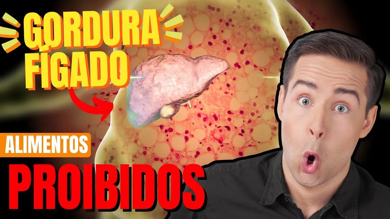 Quem Tem Gordura no Fígado: O Que Não Pode Comer