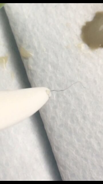 Morgellons in masks ...