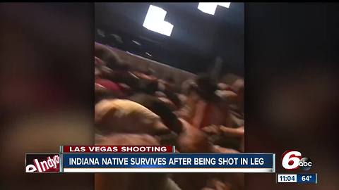 Bullet grazes leg of Indiana native at Las Vegas concert