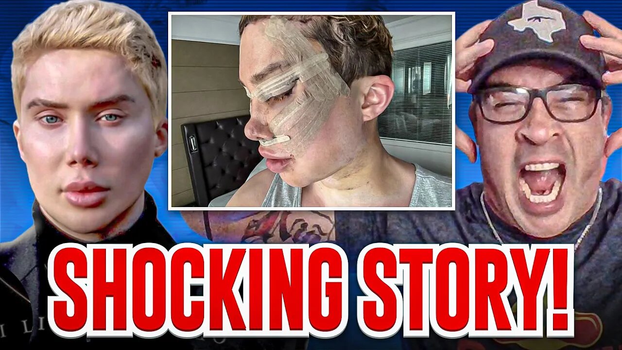 "SHOCKING!" Transgender TELLS ALL! Bullied But Not Broken. MUST SEE