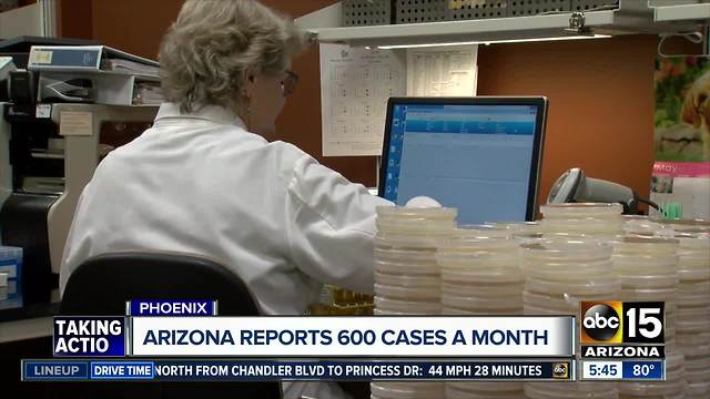 Valley Fever cases skyrocket; how you can get tested