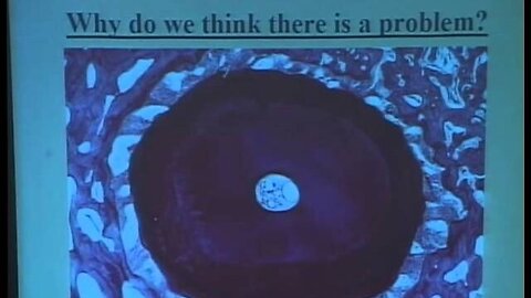 Dr. Steve Koral discusses alternative materials for obturation in root canals IAOMT Kansas City 2005