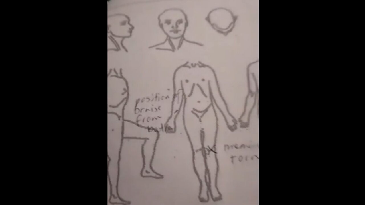 Debbie Els Vs Beseringsverslae