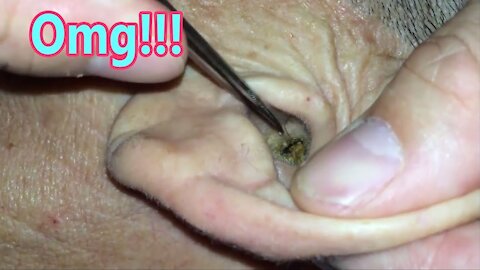 Ear Cleaning with Relaxing Music #04