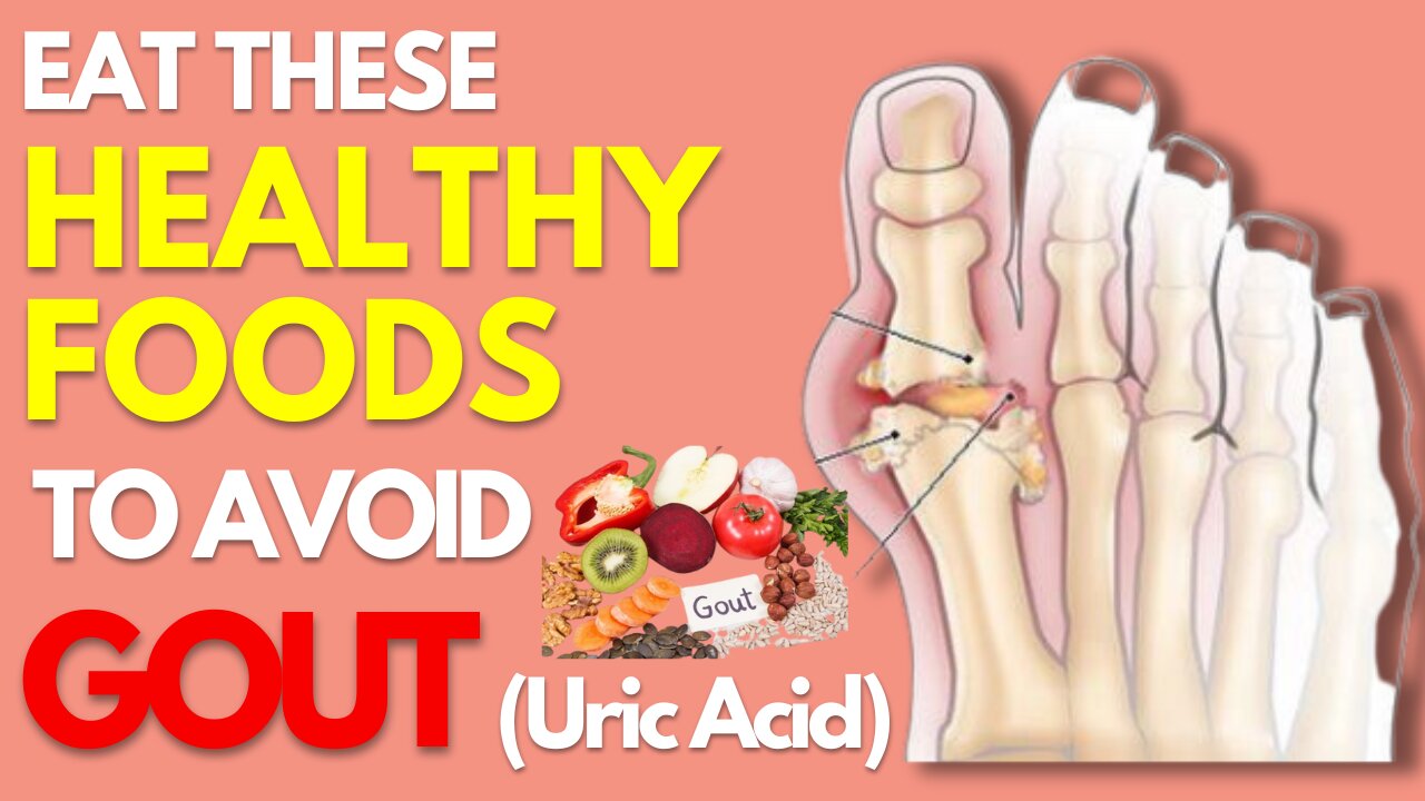 Bring Your Uric Acid Down with These Food Tips