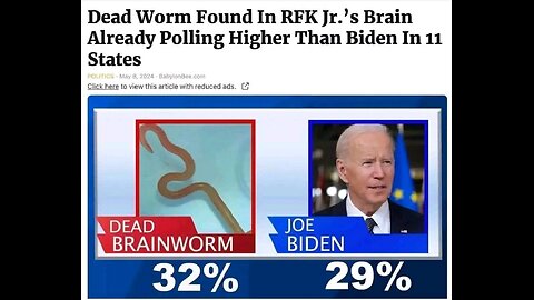 Crohn's disease 🤔🤔🤔