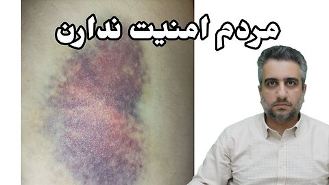 مردم امنیت ندارن