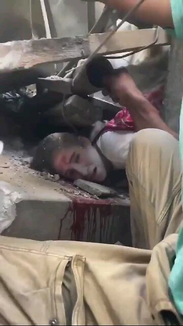 Rescue workers try so hard to stop an entire building collapse on da head of a young Palestinian ⏬de