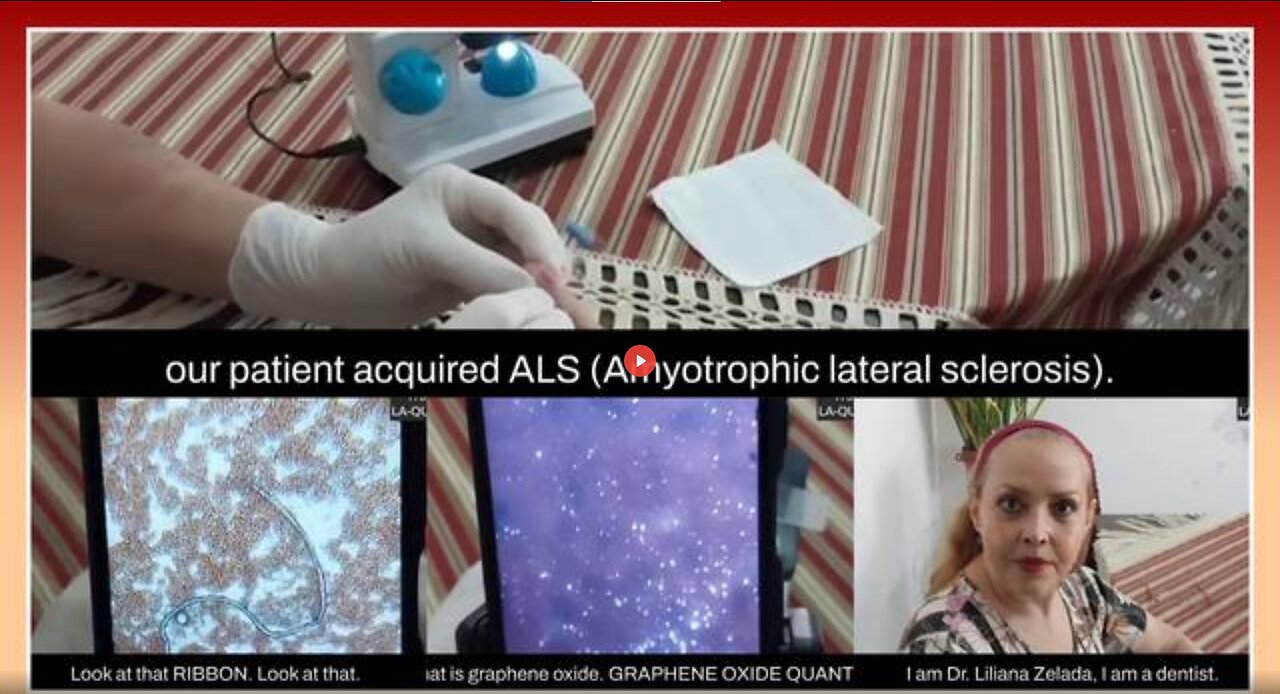 LQC: MICROSCOPIC ANALYSIS OF A DROP OF BLOOD FROM A PERSON "VACCINATED" WITH SINOPHARM