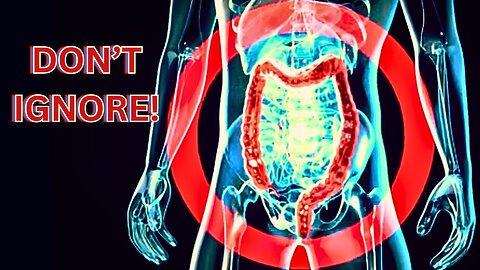 DON’T IGNORE These EARLY WARNING Signs Of COLON CANCER!
