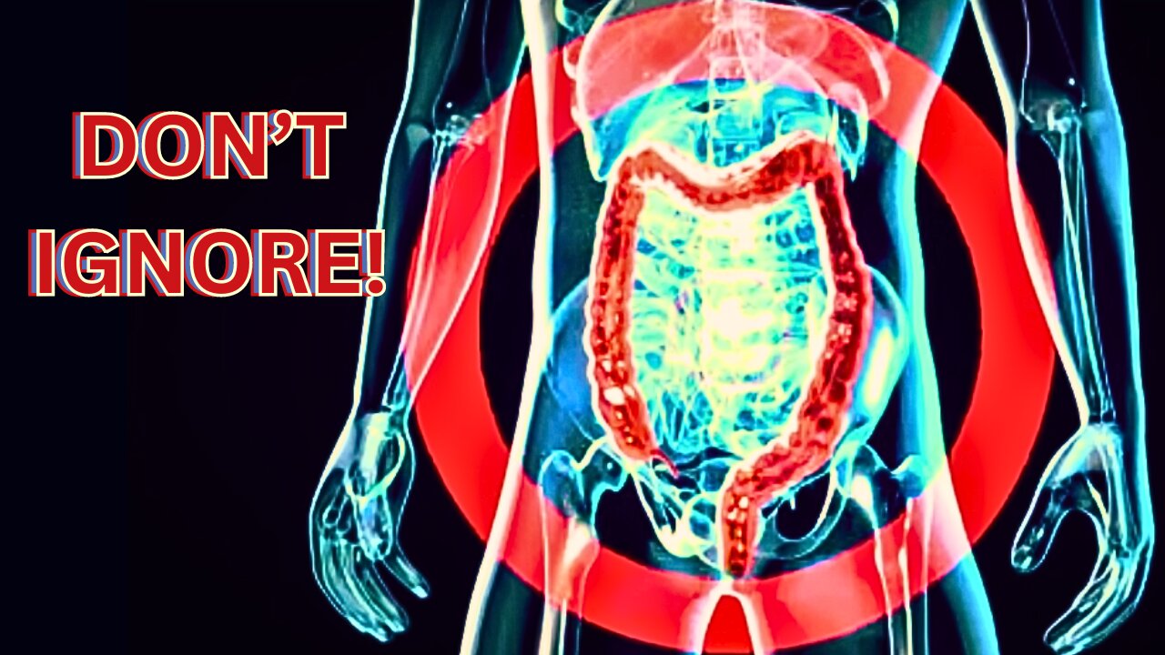 DON’T IGNORE These EARLY WARNING Signs Of COLON CANCER!