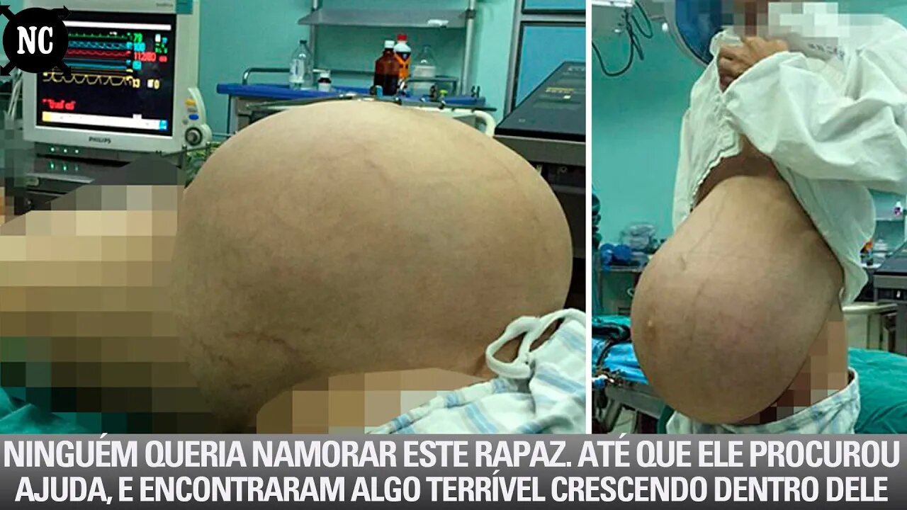 Ninguém queria namorar este rapaz. Até que ele procurou ajuda, e encontraram algo terrível crescendo