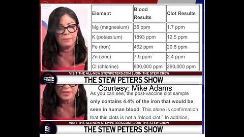סטו פיטר נתיחה מיקרוסקופית מגלה שקרישי הדם שנמצאים אצל מתים בפתאומיות אינן קרישי דם אמיתיים