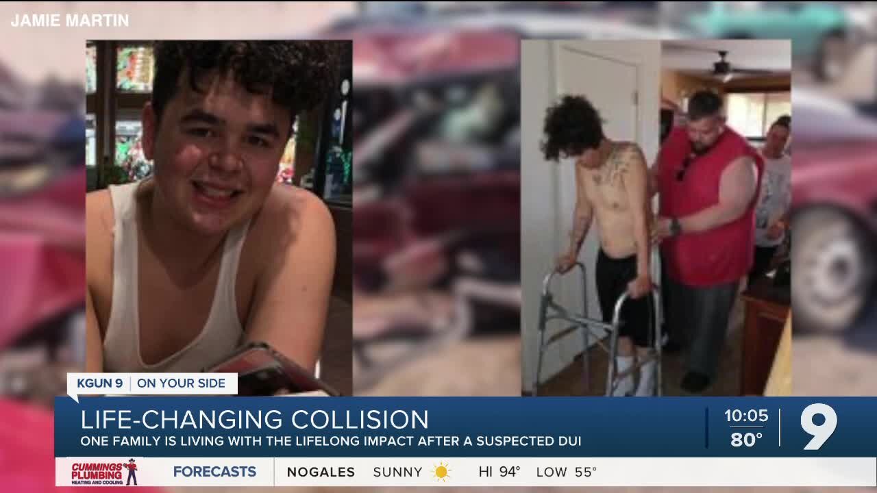 Mother speaks out after her son's life-changing collision