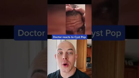 What came out of his head?