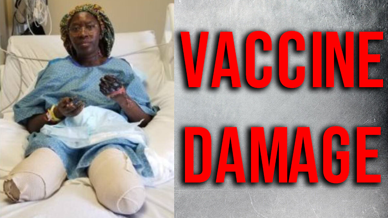 Loss of BOTH Legs, BOTH Hands — Vaccine, Blood Clots