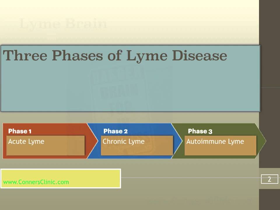 Lyme Brain Book by Dr. Kevin Conners of Conners Clinic | Chronic Lyme Disease