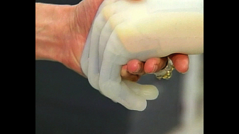 i-LIMB: Bionic Hand