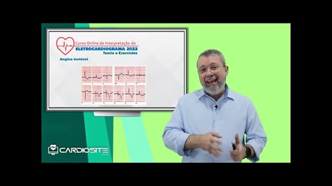 ECG NA SCA SEM SUPRA DE ST