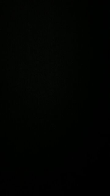 Pancreaticoduodenectomy