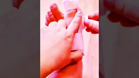 amazing gadgets to recover your toe position