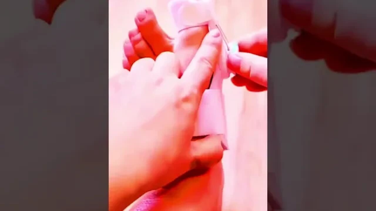 amazing gadgets to recover your toe position