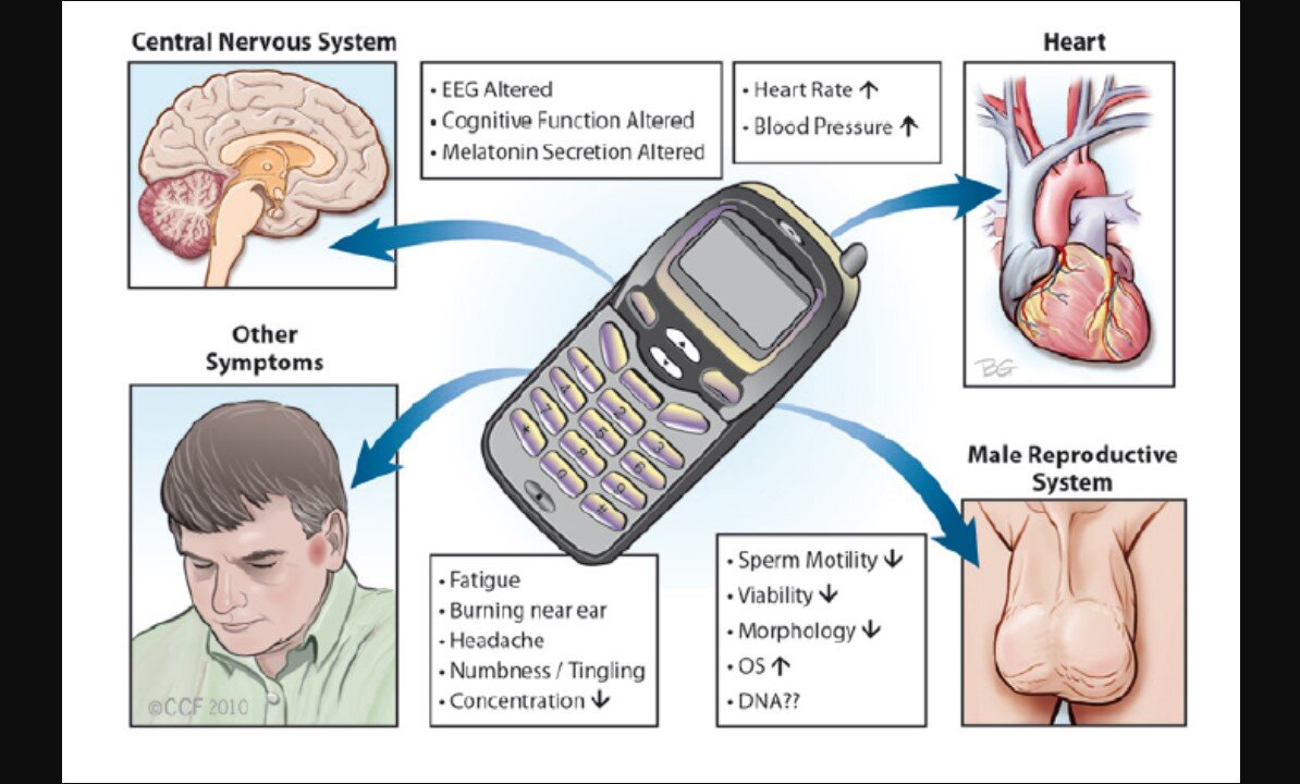 5G Connection Between Coronavirus Disease-19