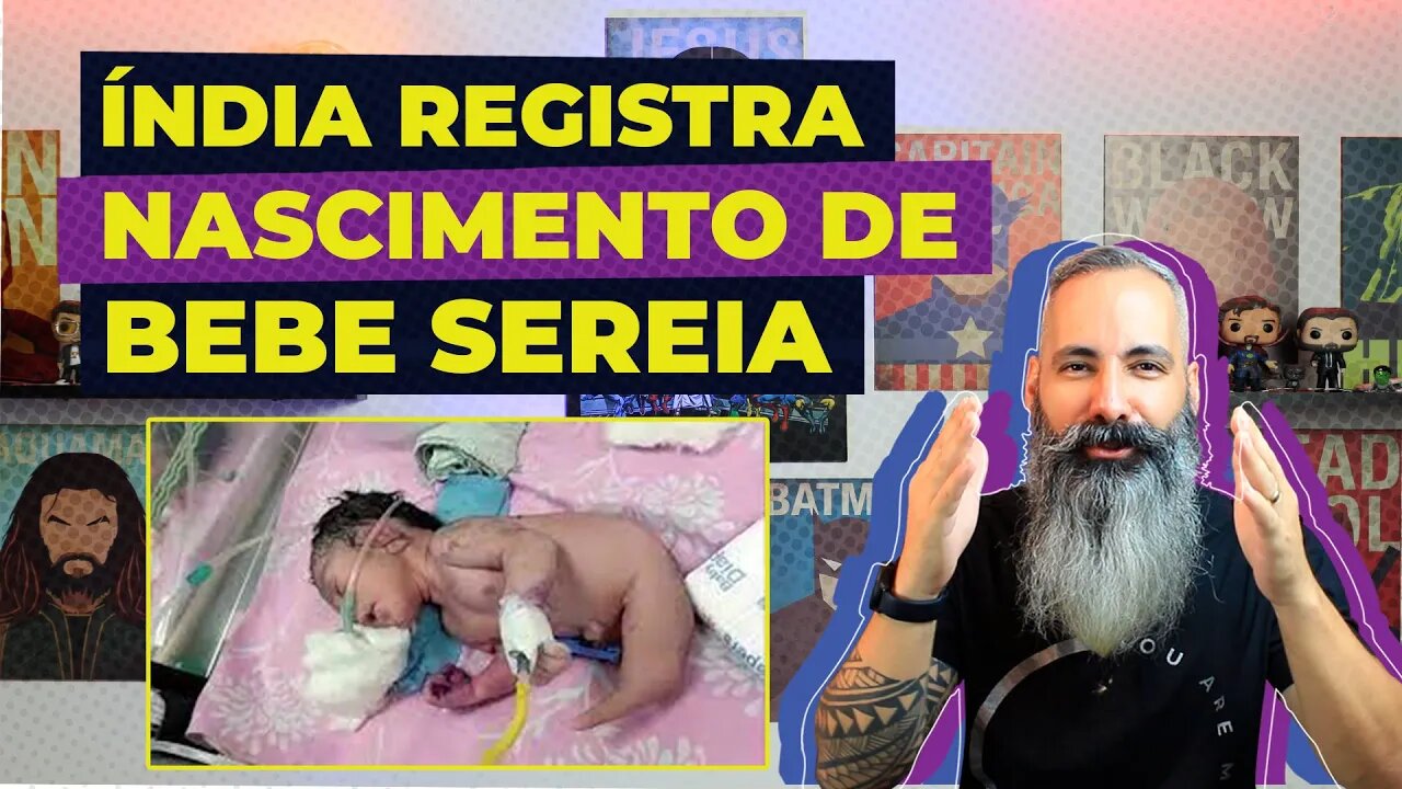 ÍNDIA registra nascimento de "BEBÊ SEREIA", que atrai multidão a maternidade