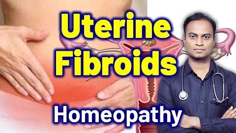 How to Treat Uterine Fibroids? Cure Medicine Surgery | Gynaecology Women Female | Dr. Bharadwaz