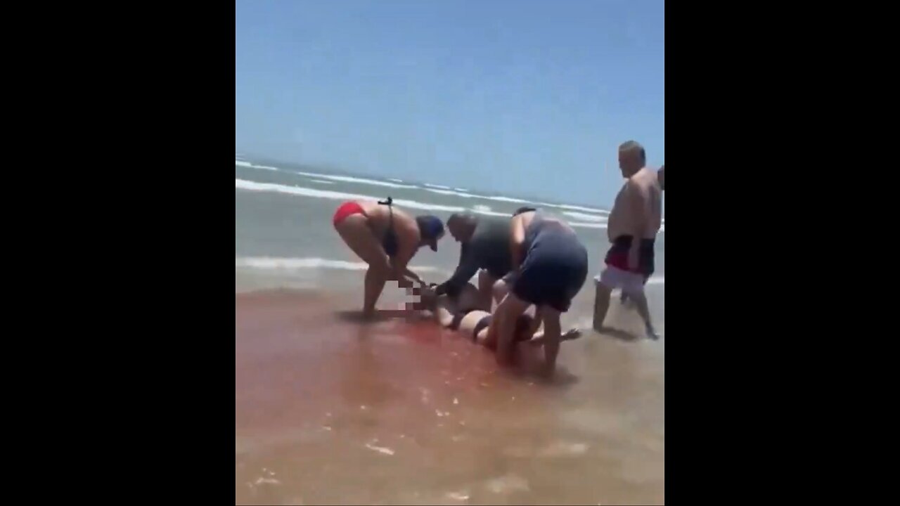 4 shark 🦈 attacks in South Padre Island Texas