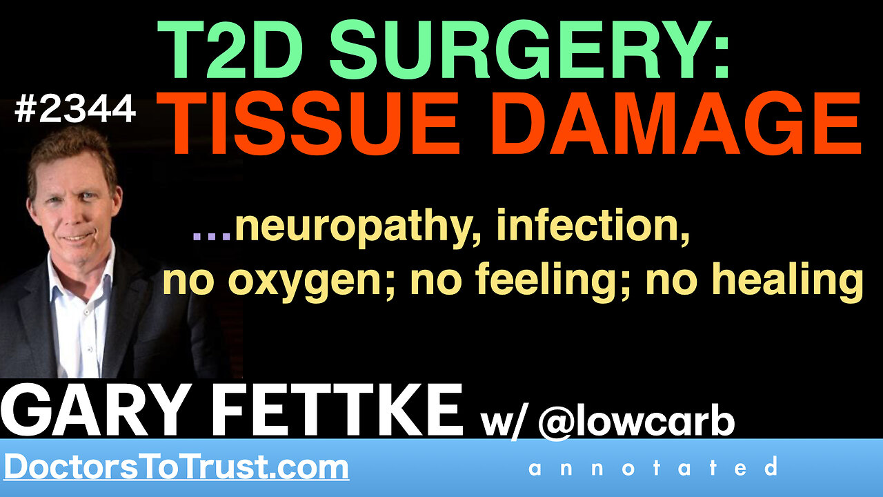 GARY FETTKE w1 | T2D SURGERY: TISSUE DAMAGE infection, no oxygen; no feeling; no healing