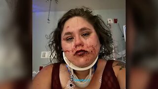 Oakland Woman Ready To Flee City After Black Youths Severely Beat Her While Yelling 'Die Fat Bitch'