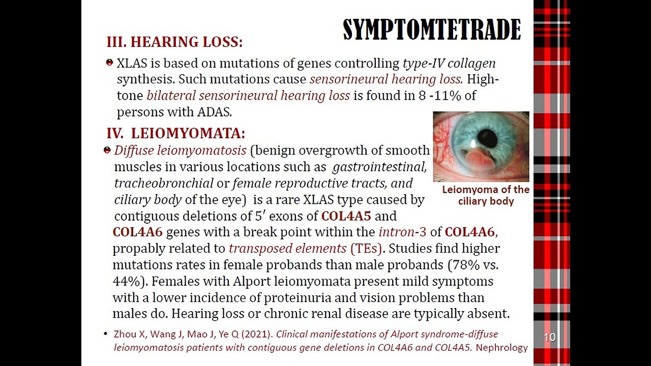 ALPORT SYNDROME in Pregnancy