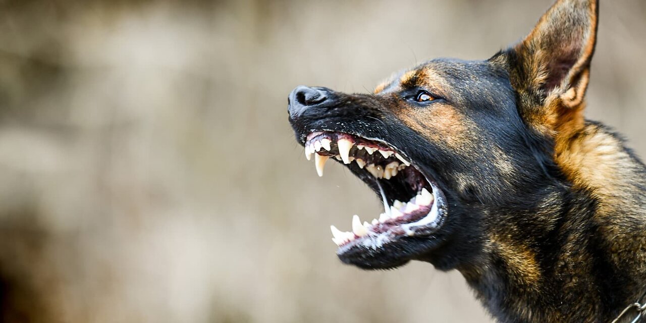 VICIOUS DOG ATTACK WATCH TILL THE END