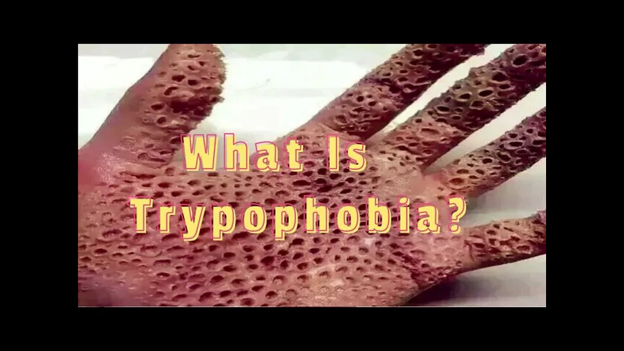 What Is Trypophobia? 😵