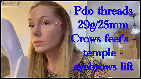 Open your look with PDO THREADS eyebrows and crow’s feet.