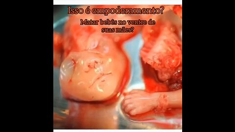 Diga não ao aborto