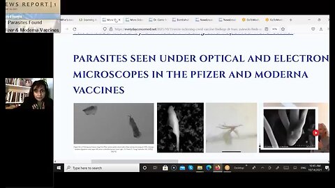 4 Parasites Found In Pfizer Moderna Covid-19 - 10-14-21