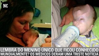 Lembra Do Menino Único Que Ficou Conhecido Mundialmente? Os Médicos Deram Uma Triste Notícia