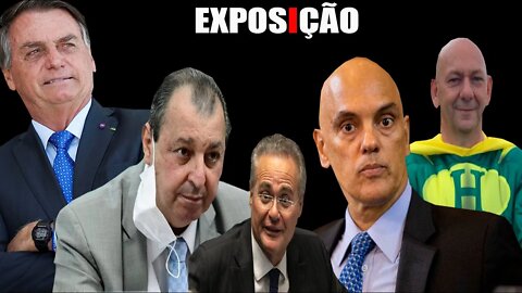 A EXPOSIÇÃO DELES ACONTECEU