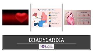 BRADYCARDIA - CAUSES AND SOLUTIONS | True Pathfinder