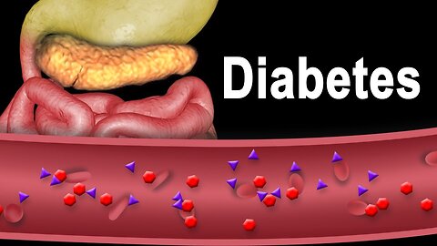 Diabetes Type 1 and Type 2, Animation.