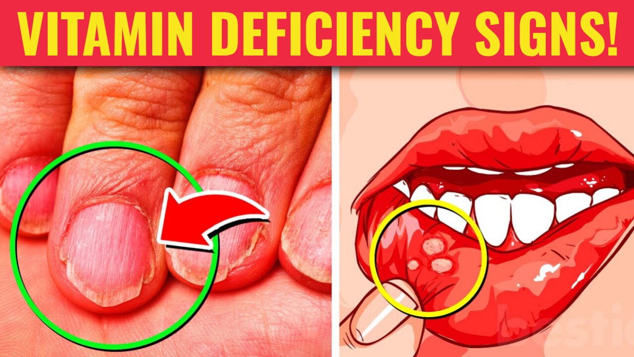 The 10 Hidden Signs Of Nutrient Deficiency You Should Never Ignore