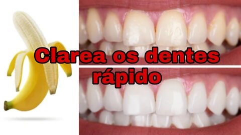 Tenha Dentes Brancos em um dia!