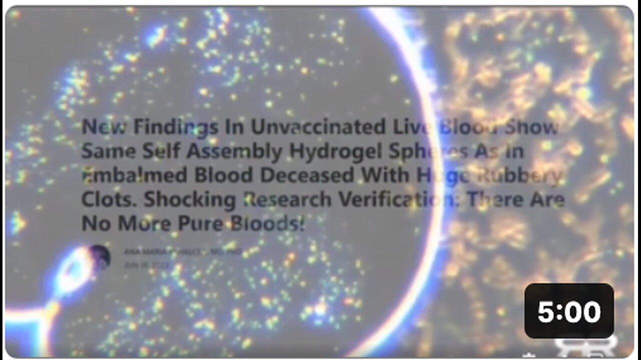 New Findings In Unvaccinated Live Blood Show Same Self Assembly Hydrogel Spheres