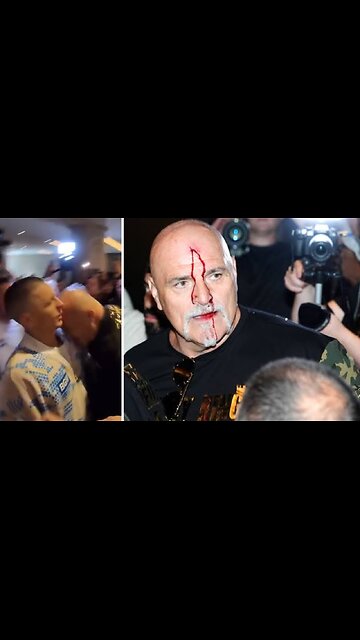 John Fury headbutts a lad who stands there unfazed