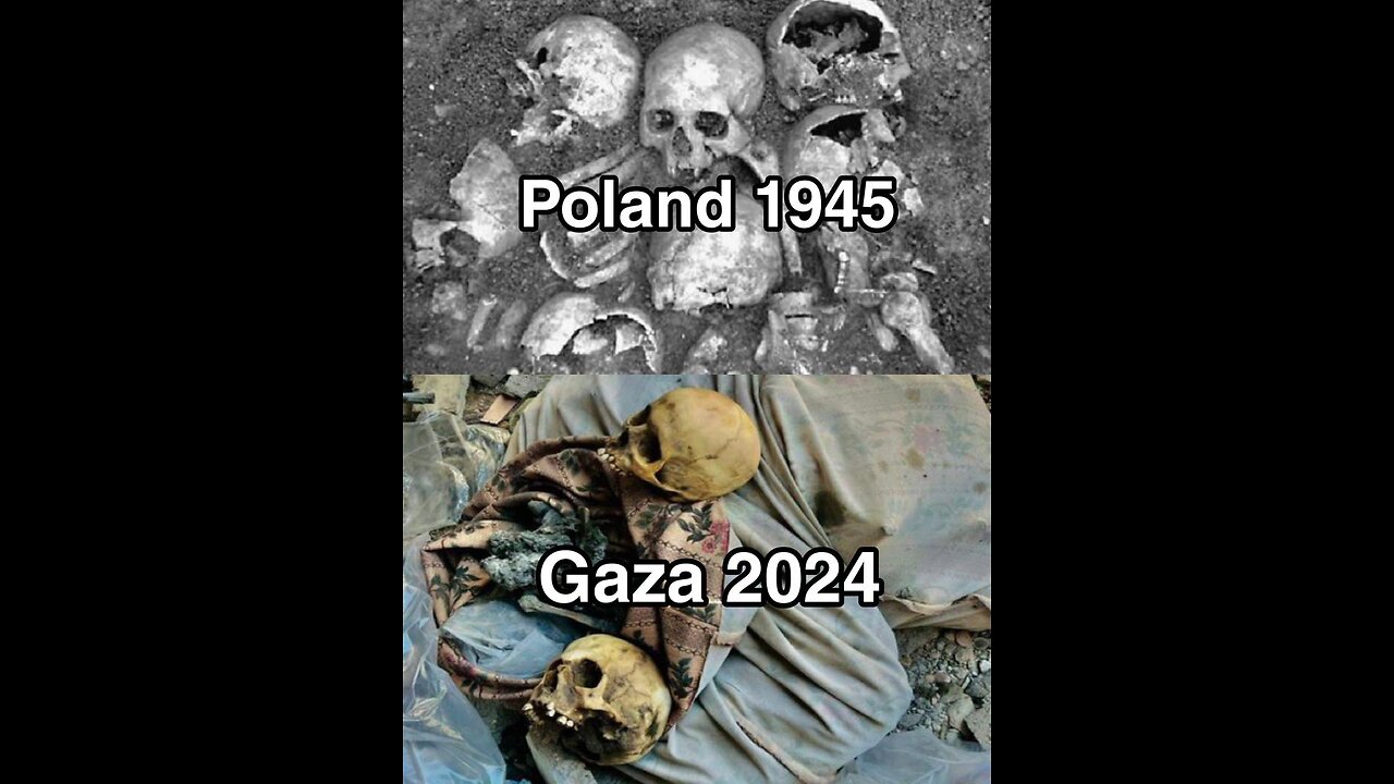 GAZA Haulucaset Child Killer War of Israeel Sponsred by US UK and allies