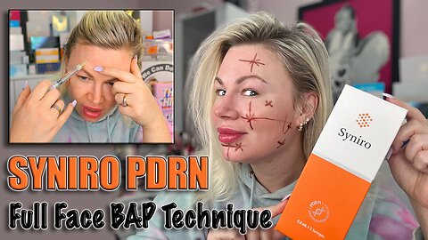 Syniro PDRN FULL FACE BAP Technique in DETAIL! AceCosm, Code Jessica10 Saves you Money